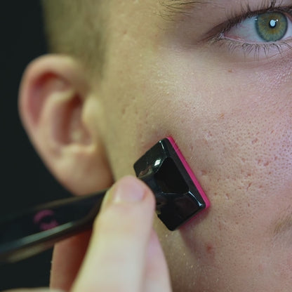 4 db Dermastamp (1 mm)